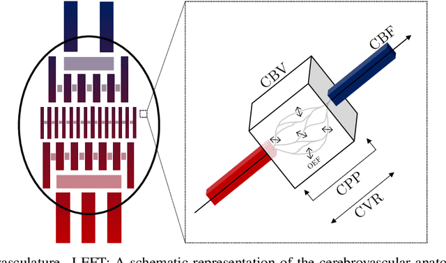 Figure 1 for Final infarct prediction in acute ischemic stroke