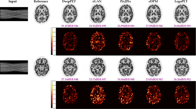 Figure 3 for LegoPET: Hierarchical Feature Guided Conditional Diffusion for PET Image Reconstruction