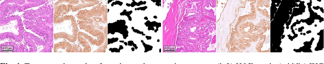 Figure 1 for Automated Volume Corrected Mitotic Index Calculation Through Annotation-Free Deep Learning using Immunohistochemistry as Reference Standard