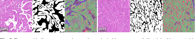 Figure 3 for Automated Volume Corrected Mitotic Index Calculation Through Annotation-Free Deep Learning using Immunohistochemistry as Reference Standard