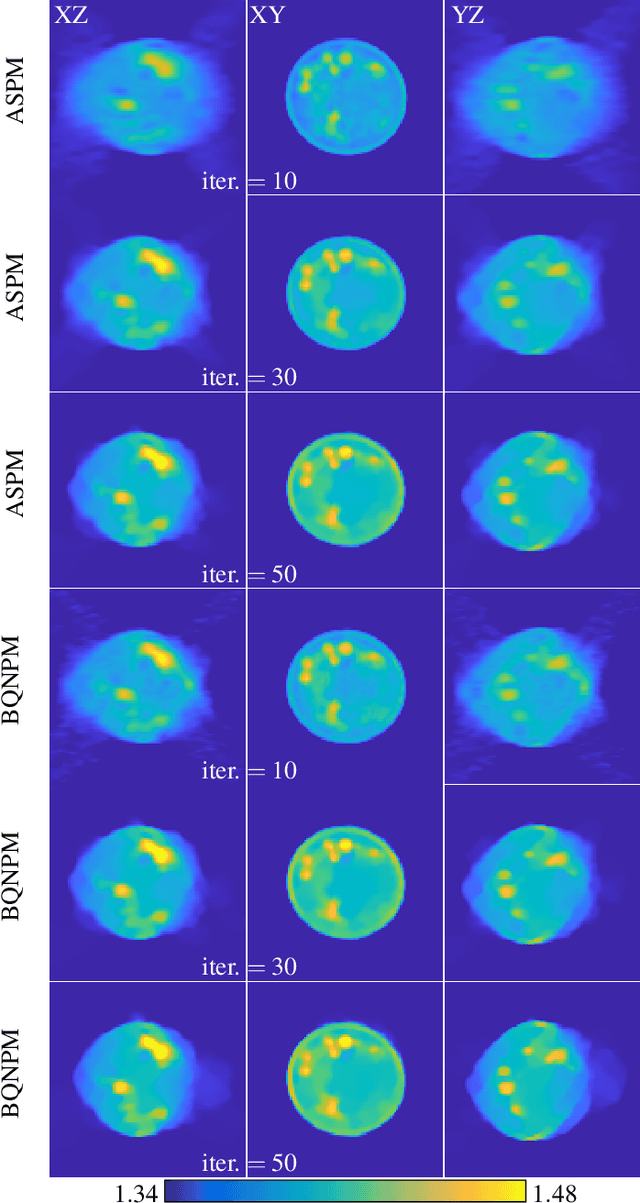Figure 2 for A Mini-Batch Quasi-Newton Proximal Method for Constrained Total-Variation Nonlinear Image Reconstruction