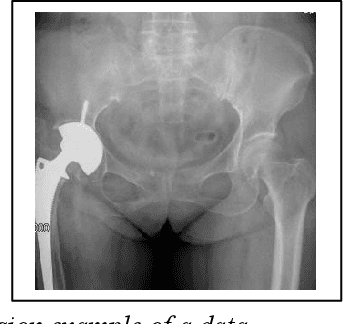 Figure 3 for A multimodal method based on cross-attention and convolution for postoperative infection diagnosis