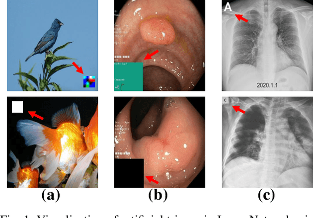 Figure 1 for Backdoor Attack on Unpaired Medical Image-Text Foundation Models: A Pilot Study on MedCLIP