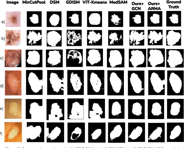 Figure 4 for UnSeGArmaNet: Unsupervised Image Segmentation using Graph Neural Networks with Convolutional ARMA Filters