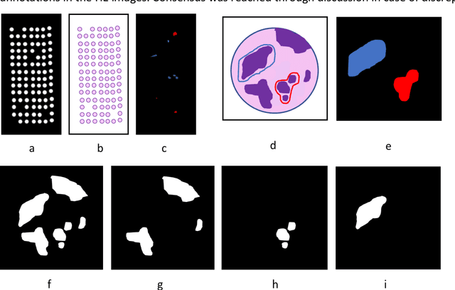 Figure 2 for Immunohistochemistry guided segmentation of benign epithelial cells, in situ lesions, and invasive epithelial cells in breast cancer slides