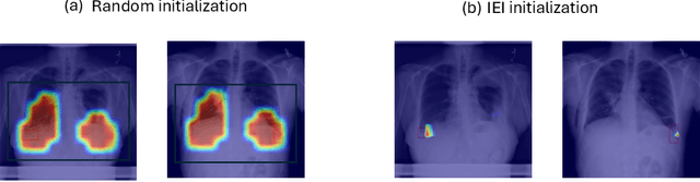 Figure 3 for Dwarf: Disease-weighted network for attention map refinement