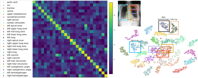 Figure 4 for Region-based Contrastive Pretraining for Medical Image Retrieval with Anatomic Query