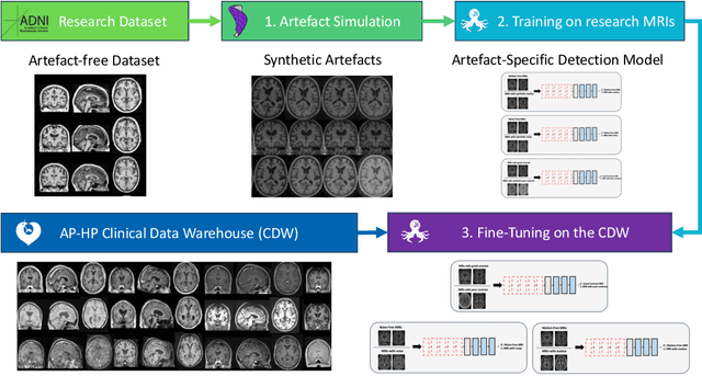 Figure 4 for Automated MRI Quality Assessment of Brain T1-weighted MRI in Clinical Data Warehouses: A Transfer Learning Approach Relying on Artefact Simulation