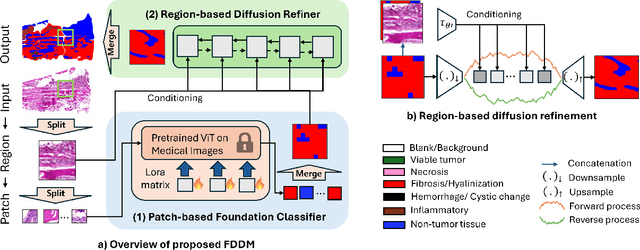 Figure 1 for Bridging Classification and Segmentation in Osteosarcoma Assessment via Foundation and Discrete Diffusion Models