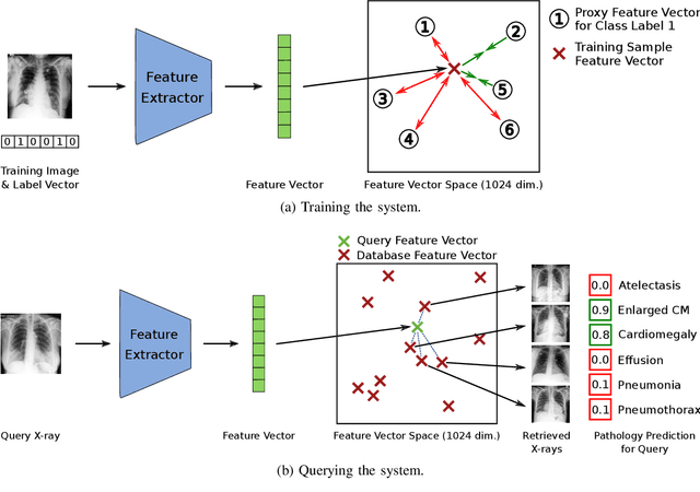 Figure 2 for Multimorbidity Content-Based Medical Image Retrieval Using Proxies