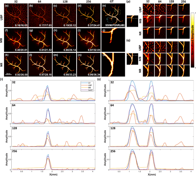 Figure 3 for Sparse-view Signal-domain Photoacoustic Tomography Reconstruction Method Based on Neural Representation