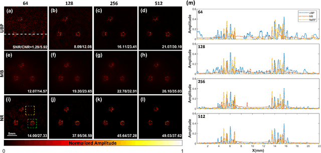 Figure 4 for Sparse-view Signal-domain Photoacoustic Tomography Reconstruction Method Based on Neural Representation