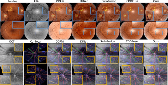 Figure 3 for TaGAT: Topology-Aware Graph Attention Network For Multi-modal Retinal Image Fusion