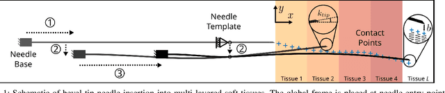 Figure 1 for Shape Manipulation of Bevel-Tip Needles for Prostate Biopsy Procedures: A Comparison of Two Resolved-Rate Controllers