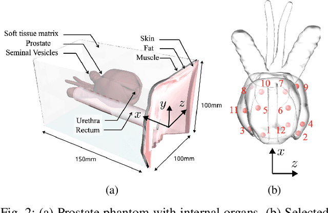 Figure 2 for Shape Manipulation of Bevel-Tip Needles for Prostate Biopsy Procedures: A Comparison of Two Resolved-Rate Controllers