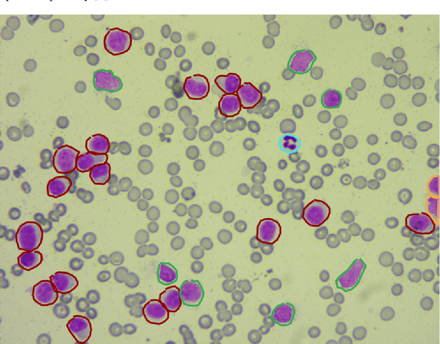 Figure 3 for Segmentation of the veterinary cytological images for fast neoplastic tumors diagnosis