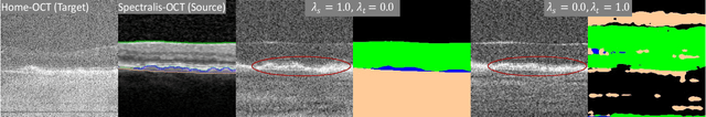 Figure 3 for Anatomical Conditioning for Contrastive Unpaired Image-to-Image Translation of Optical Coherence Tomography Images