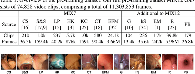 Figure 2 for EndoMamba: An Efficient Foundation Model for Endoscopic Videos