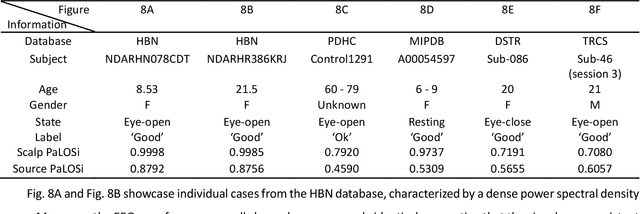 Figure 4 for Parallel Log Spectra index : a quality metric in large scale resting EEG preprocessing