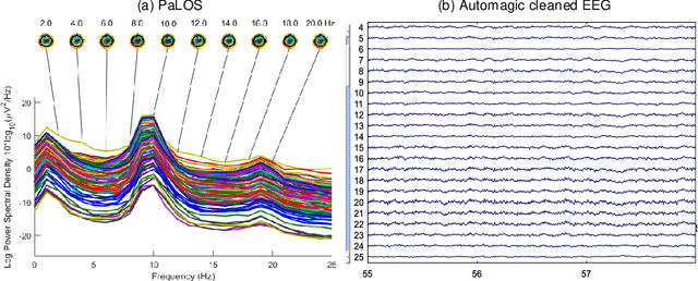 Figure 1 for Parallel Log Spectra index : a quality metric in large scale resting EEG preprocessing