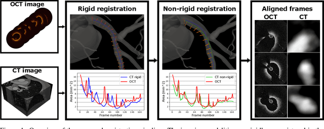 Figure 1 for Morphology-based non-rigid registration of coronary computed tomography and intravascular images through virtual catheter path optimization