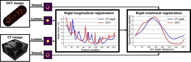 Figure 3 for Morphology-based non-rigid registration of coronary computed tomography and intravascular images through virtual catheter path optimization