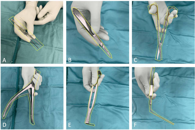 Figure 1 for Computer Vision for Increased Operative Efficiency via Identification of Instruments in the Neurosurgical Operating Room: A Proof-of-Concept Study