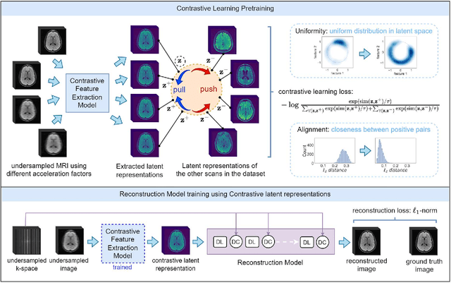 Figure 1 for Contrastive Learning MRI Reconstruction