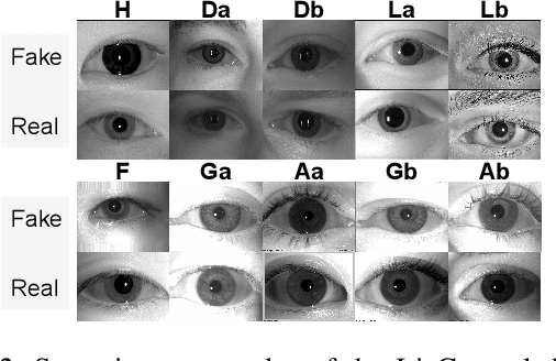 Figure 3 for A Unified Framework for Iris Anti-Spoofing: Introducing IrisGeneral Dataset and Masked-MoE Method