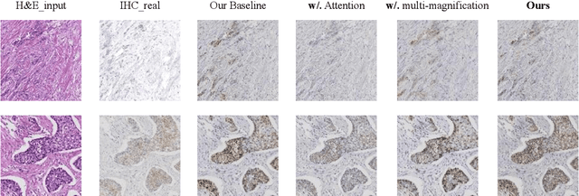 Figure 2 for Advancing H&E-to-IHC Stain Translation in Breast Cancer: A Multi-Magnification and Attention-Based Approach