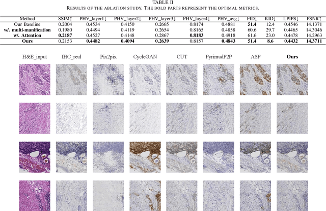 Figure 4 for Advancing H&E-to-IHC Stain Translation in Breast Cancer: A Multi-Magnification and Attention-Based Approach