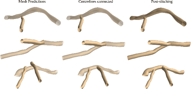 Figure 3 for 3D Coronary Vessel Reconstruction from Bi-Plane Angiography using Graph Convolutional Networks