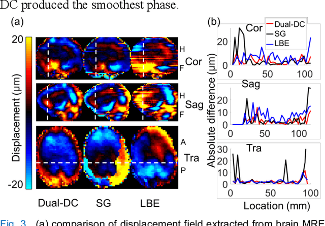 Figure 3 for MR Elastography with Optimization-Based Phase Unwrapping and Traveling Wave Expansion-based Neural Network (TWENN)