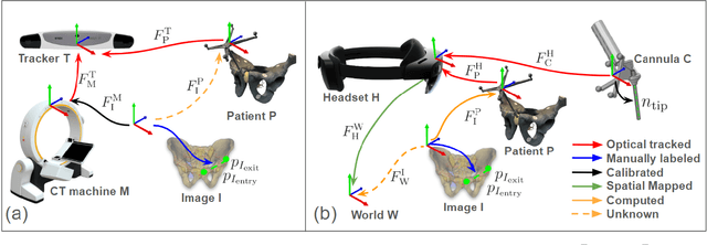 Figure 3 for StraightTrack: Towards Mixed Reality Navigation System for Percutaneous K-wire Insertion