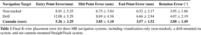 Figure 2 for StraightTrack: Towards Mixed Reality Navigation System for Percutaneous K-wire Insertion