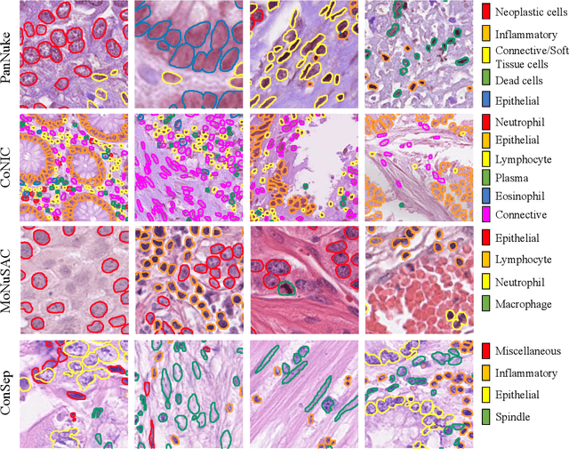 Figure 3 for Semi-Supervised Semantic Segmentation of Cell Nuclei via Diffusion-based Large-Scale Pre-Training and Collaborative Learning
