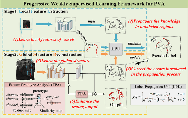 Figure 3 for Partial Vessels Annotation-based Coronary Artery Segmentation with Self-training and Prototype Learning