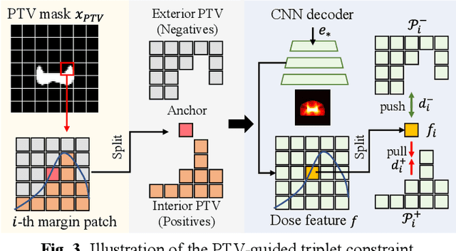 Figure 4 for Triplet-constraint Transformer with Multi-scale Refinement for Dose Prediction in Radiotherapy