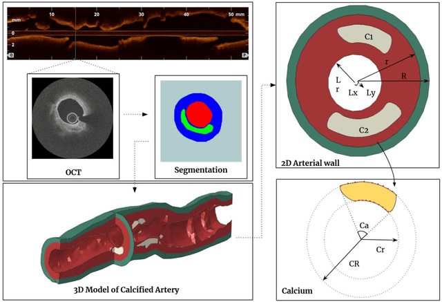 Figure 1 for Deep Learning-based Prediction of Stress and Strain Maps in Arterial Walls for Improved Cardiovascular Risk Assessment