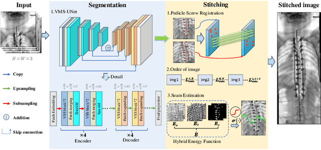 Figure 3 for SX-Stitch: An Efficient VMS-UNet Based Framework for Intraoperative Scoliosis X-Ray Image Stitching