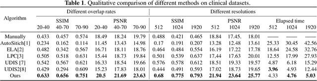 Figure 2 for SX-Stitch: An Efficient VMS-UNet Based Framework for Intraoperative Scoliosis X-Ray Image Stitching