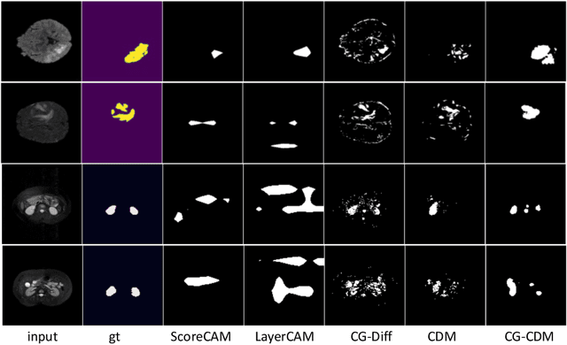 Figure 4 for Conditional Diffusion Models for Weakly Supervised Medical Image Segmentation