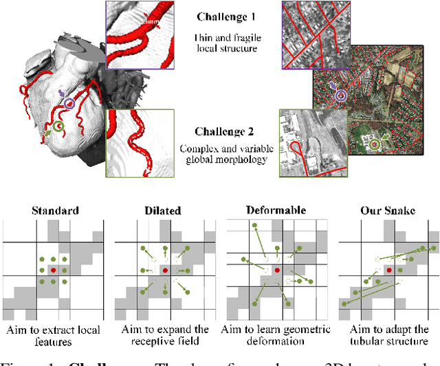 Figure 1 for Dynamic Snake Convolution based on Topological Geometric Constraints for Tubular Structure Segmentation