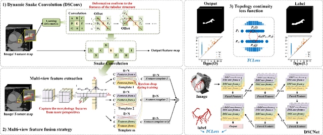 Figure 3 for Dynamic Snake Convolution based on Topological Geometric Constraints for Tubular Structure Segmentation