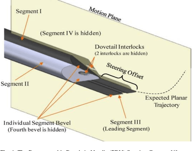 Figure 1 for Towards a Procedure Optimised Steerable Microcatheter for Deep Seated Neurosurgery