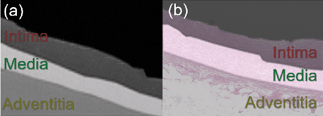 Figure 3 for Structural constrained virtual histology staining for human coronary imaging using deep learning