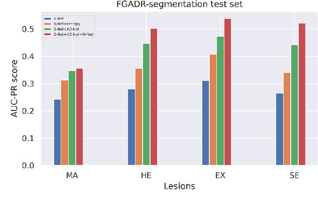 Figure 2 for DRG-Net: Interactive Joint Learning of Multi-lesion Segmentation and Classification for Diabetic Retinopathy Grading