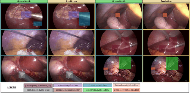 Figure 4 for Surgical Action Triplet Detection by Mixed Supervised Learning of Instrument-Tissue Interactions