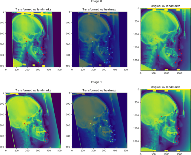 Figure 3 for landmarker: a Toolkit for Anatomical Landmark Localization in 2D/3D Images