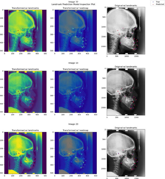 Figure 4 for landmarker: a Toolkit for Anatomical Landmark Localization in 2D/3D Images